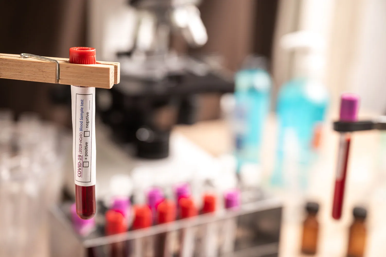 blood sample test tube for covid 19 in laboratory 2023 11 27 05 19 30 utc